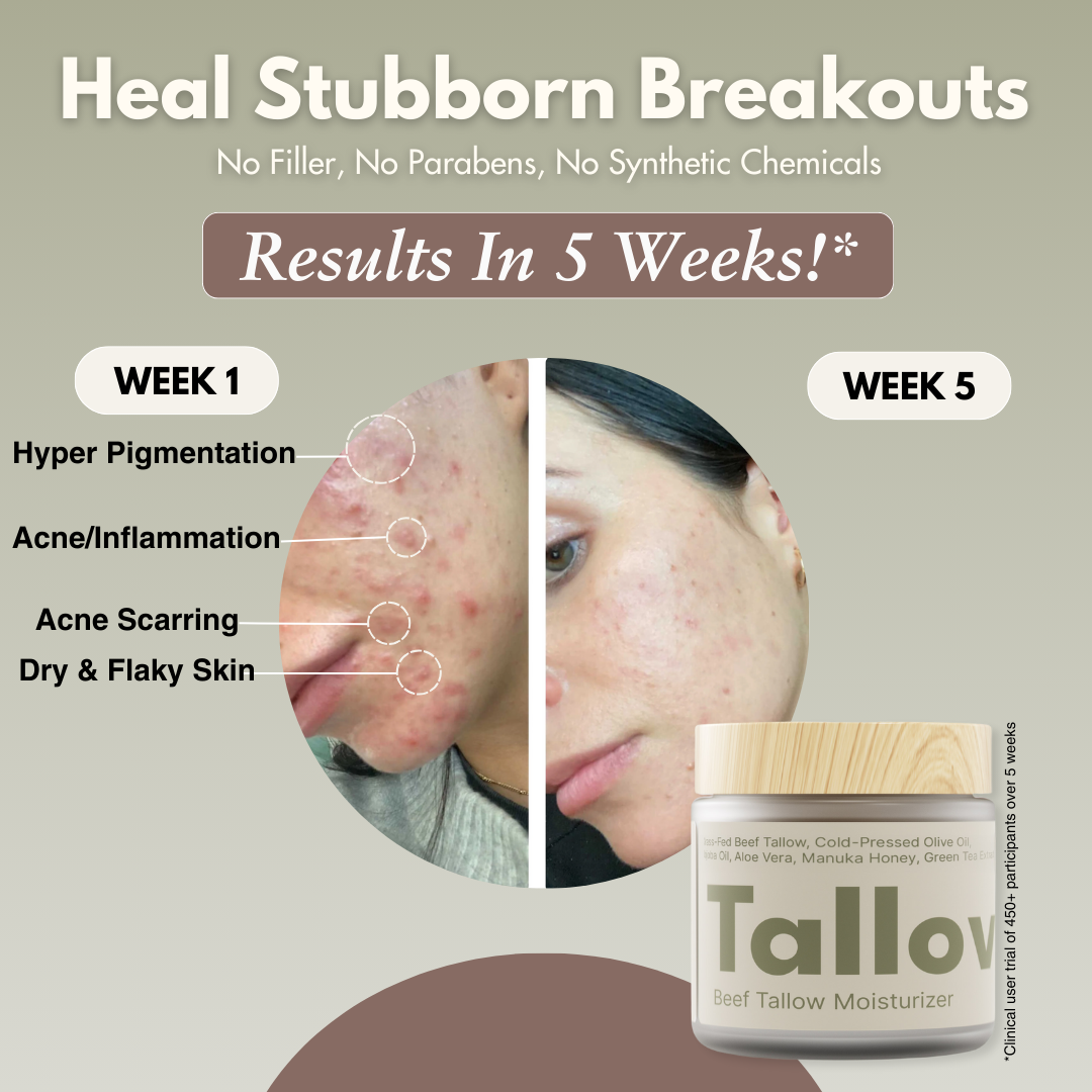 Tallovea™ Moisturizer