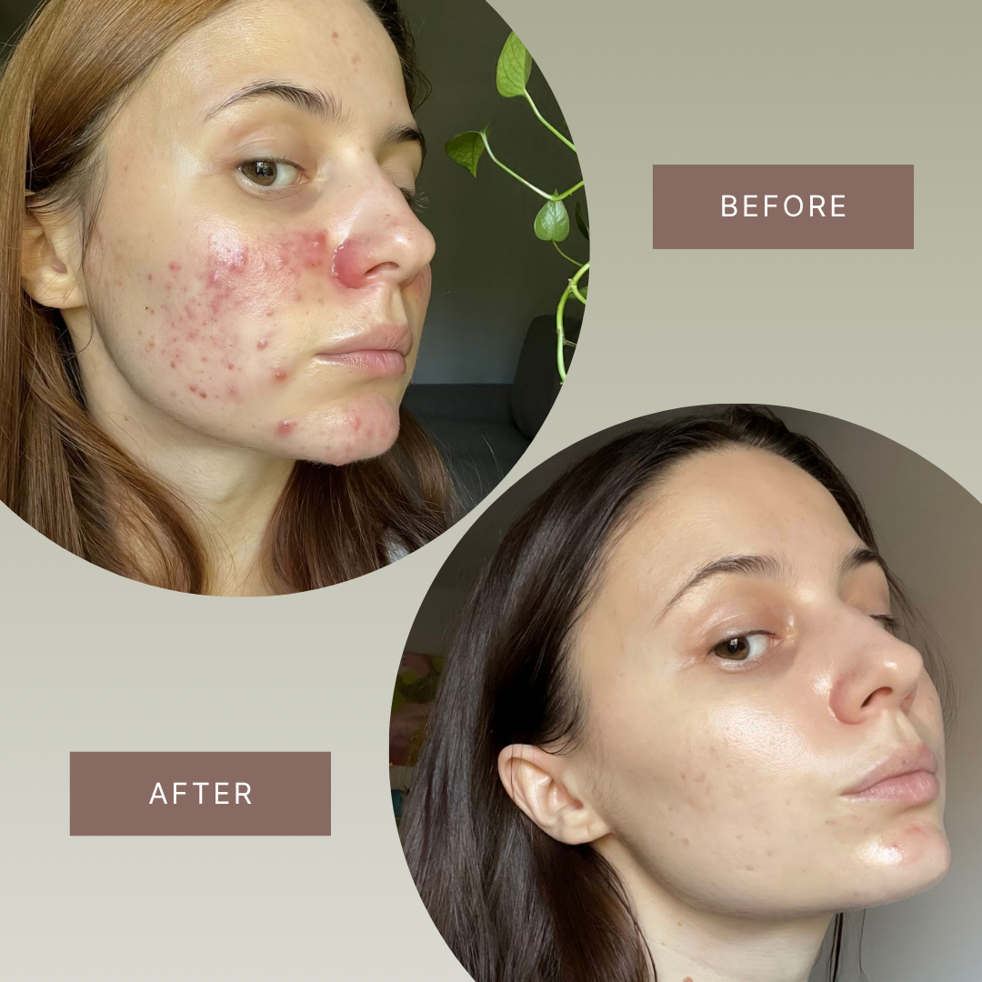 Tallovea™ Moisturizer