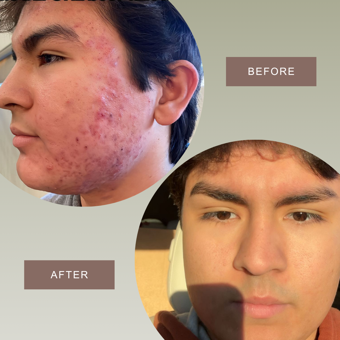Tallovea™ Moisturizer