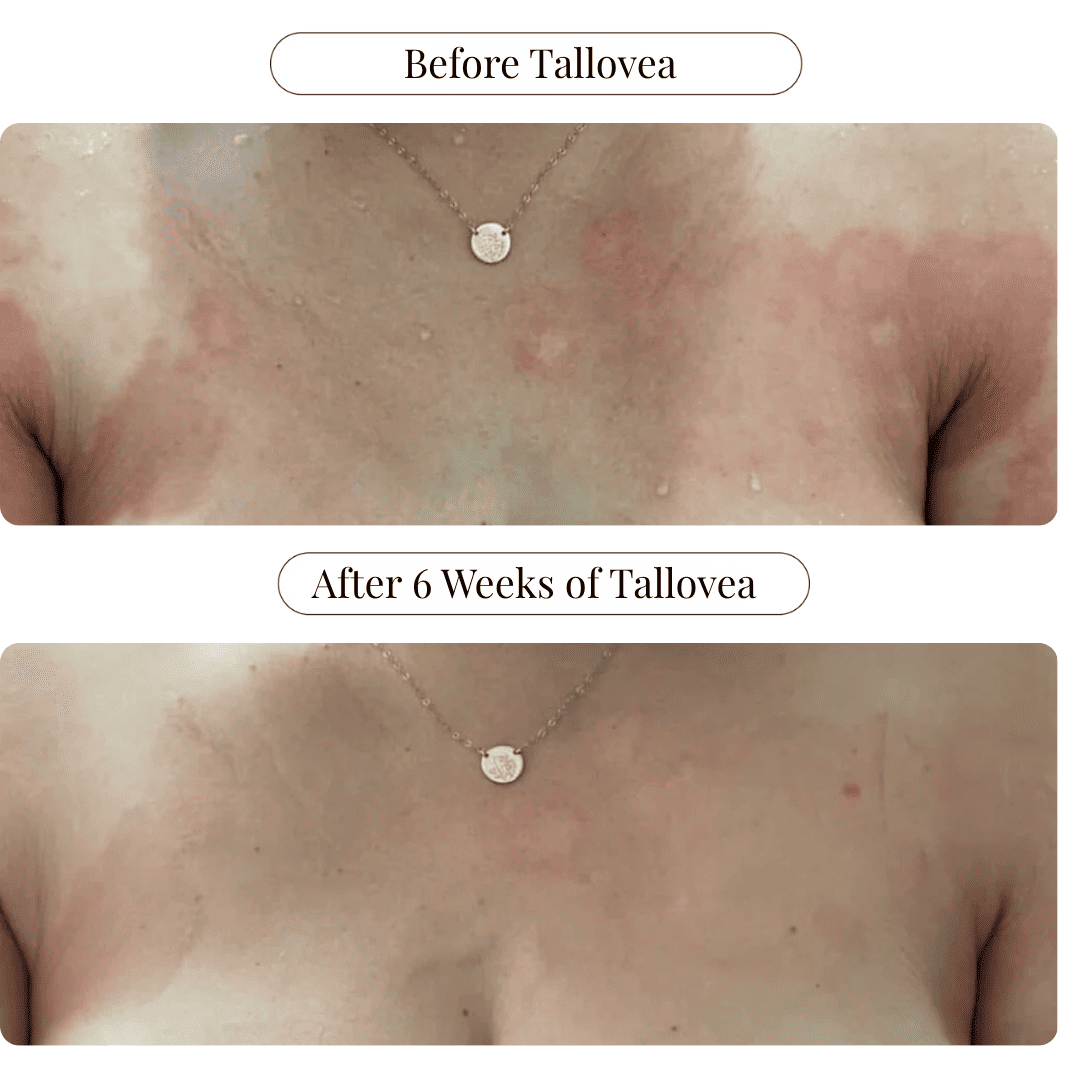 Tallovea™ Moisturizer