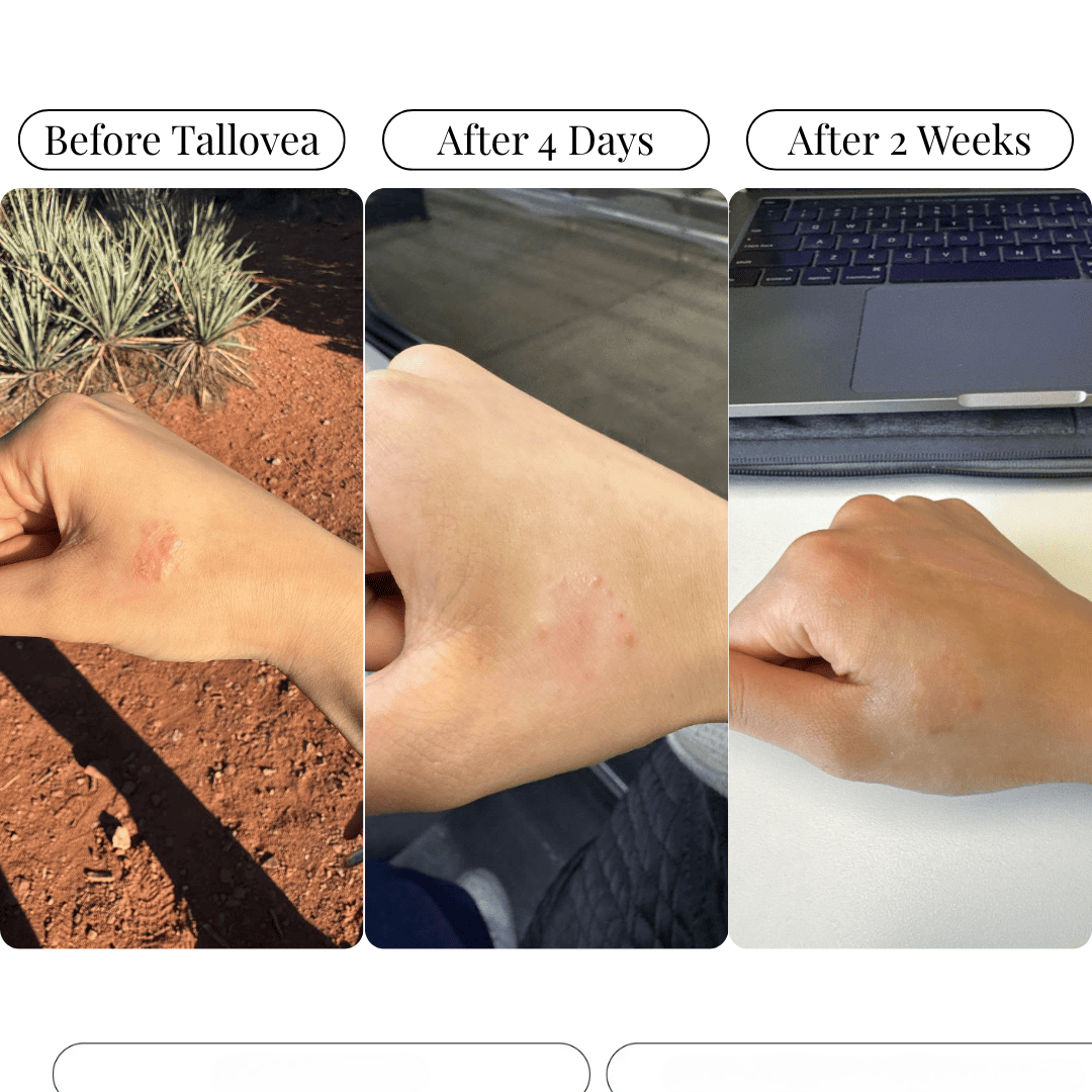 Tallovea™ Moisturizer