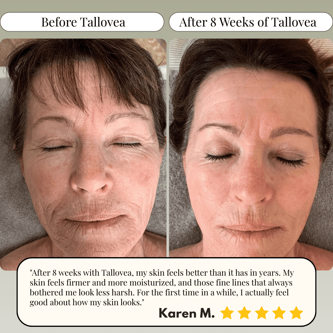 Tallovea™ Moisturizer