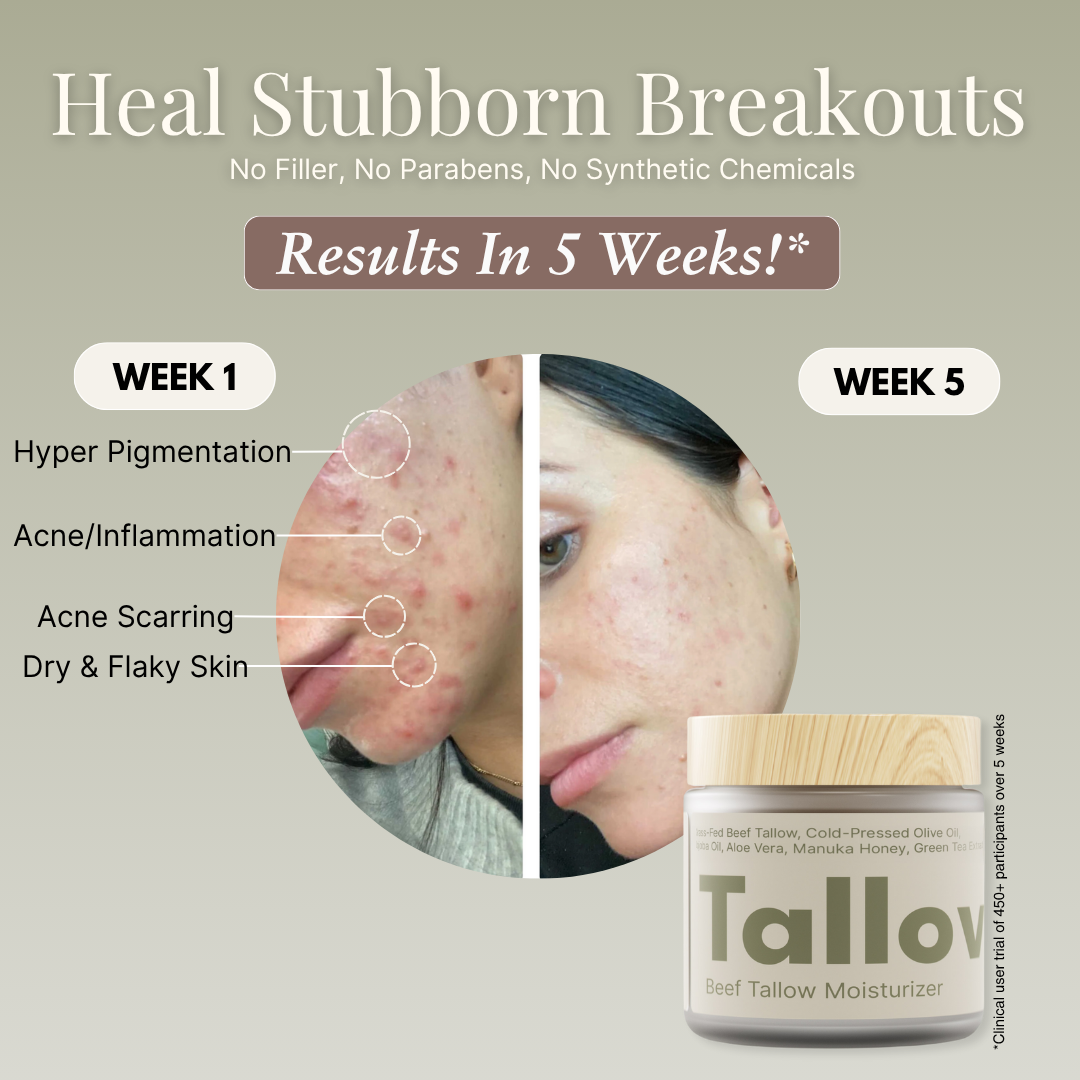 Tallovea™ Moisturizer