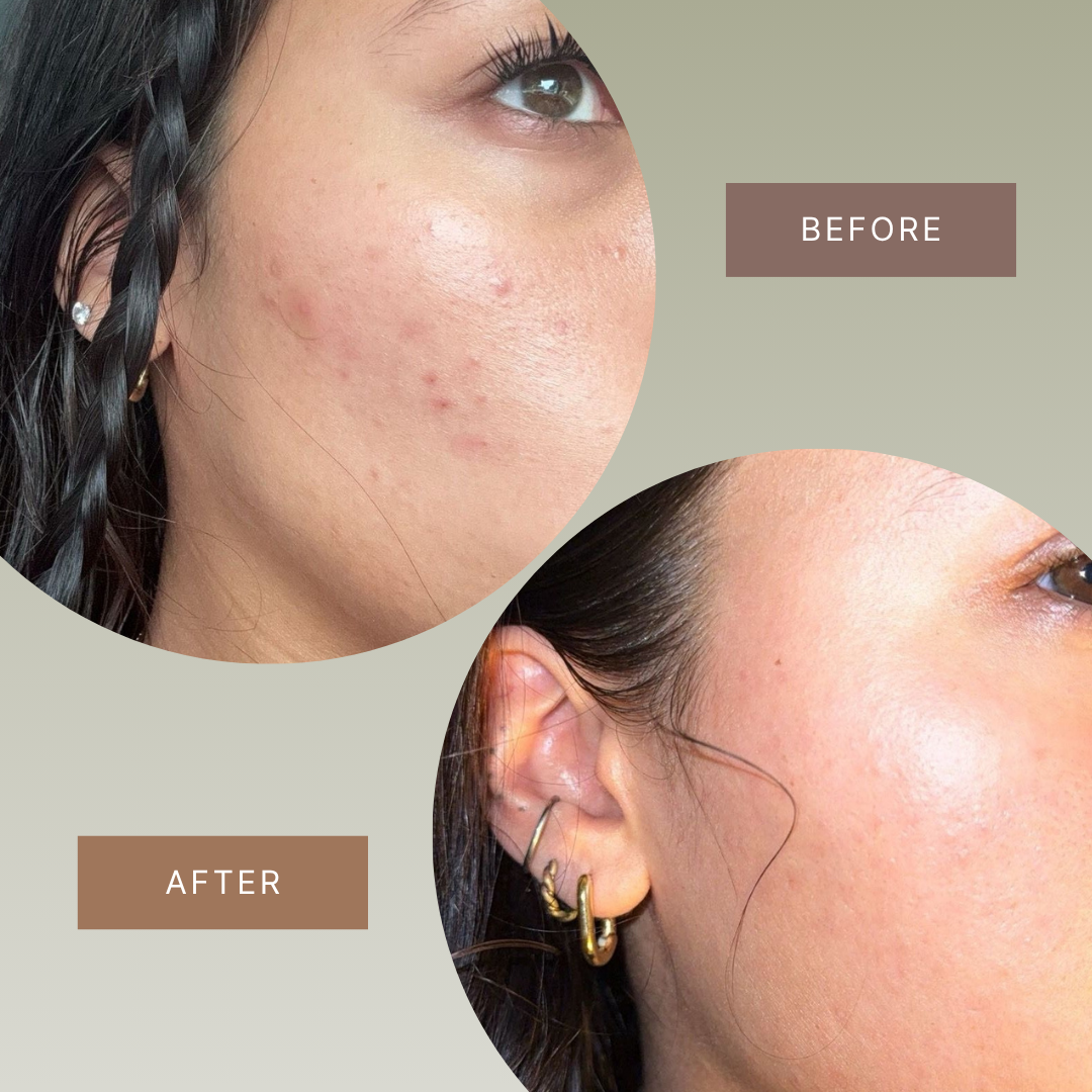 Tallovea™ Moisturizer