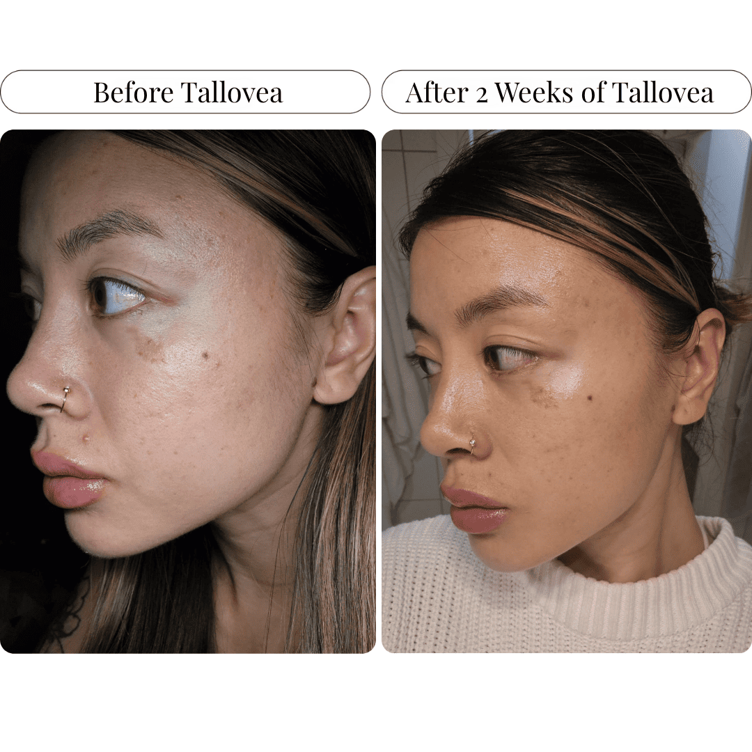Tallovea™ Moisturizer